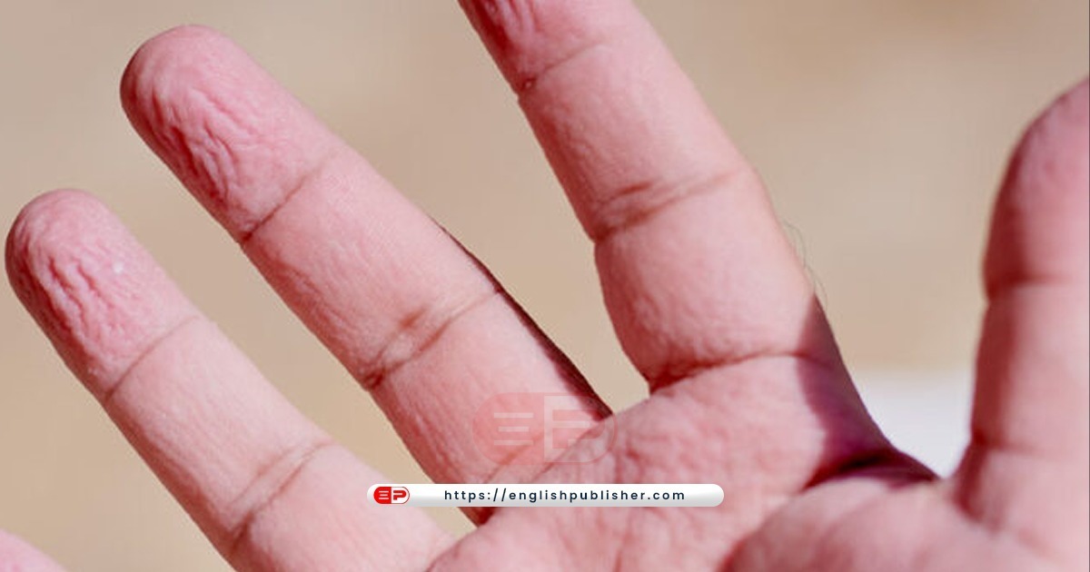 Wrinkles appearing on wet fingers